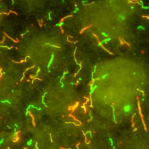 Tiny corkscrew-shaped green and orange squiggles are actually spirochetes, a type of bacteria.